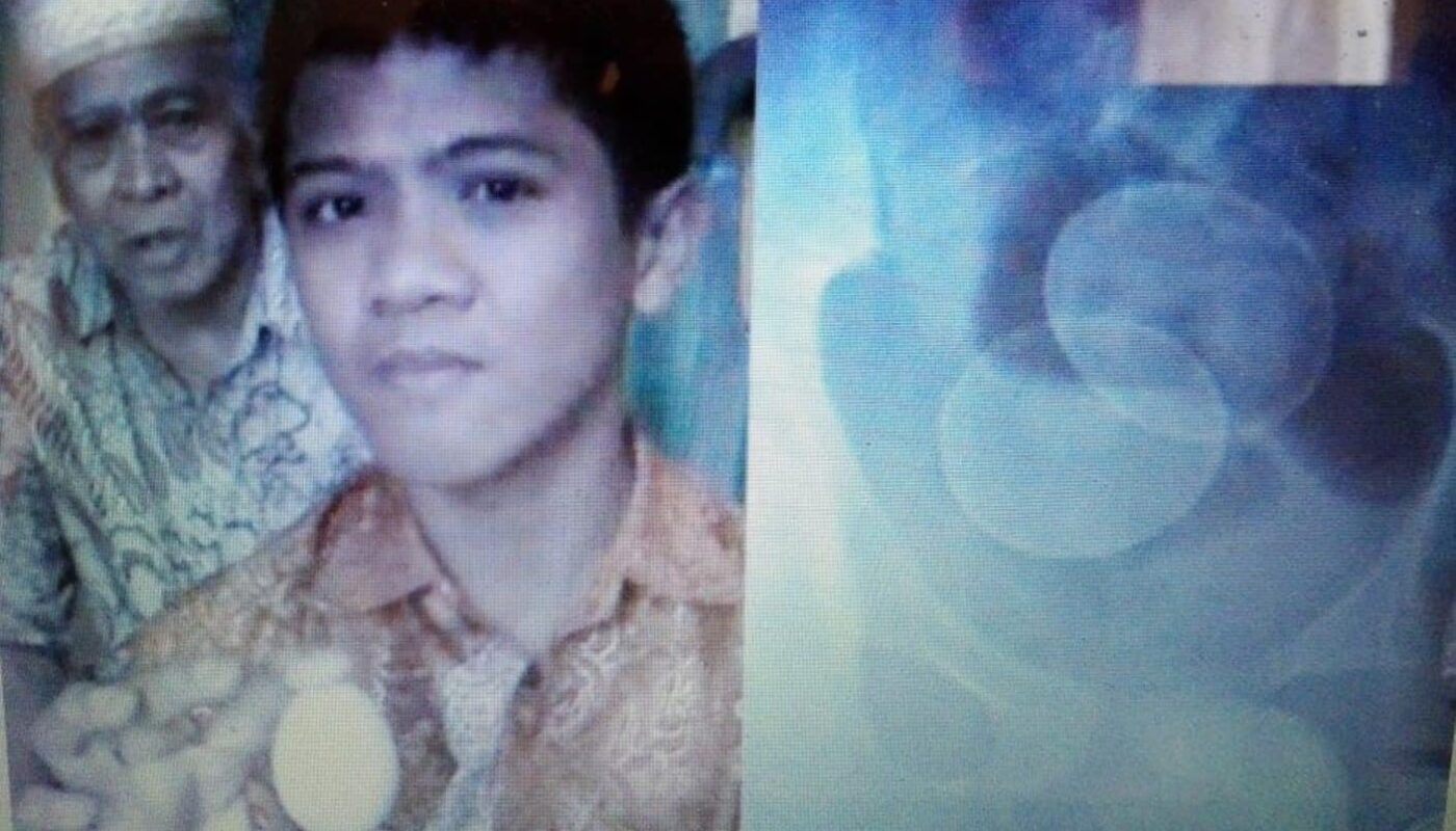 14-latek z INDONEZJI twierdzi, że zniósł 20 JAJ! Prześwietlenie wykazało, że w jego BRZUCHU znajdują się (…) (wideo)